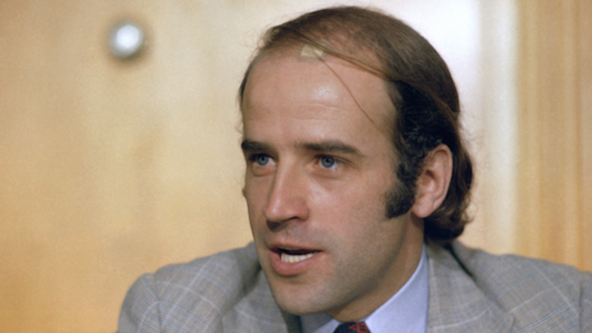 Biden's Hair Transplant Process